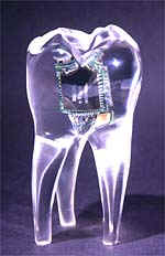 ToothTelephone aka Molar-Mobile